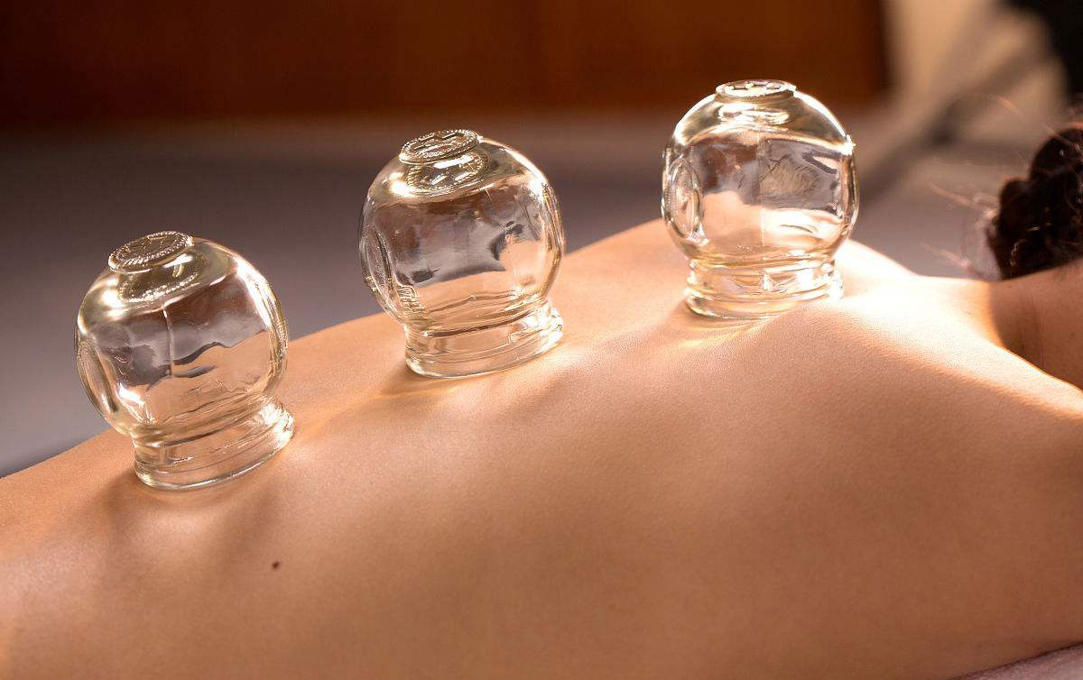 Cupping2 - Introducing Cupping to our clinic