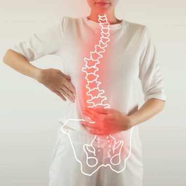 Scoliosis 380x380 - Scoliosis - How does Chiro help with it?