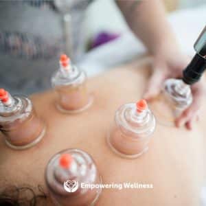 Cupping 300x300 - Remedial Massage Clinic in Burleigh Heads & Gold Coast